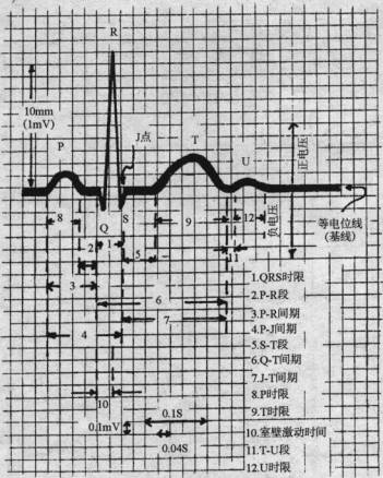 正常st段应在等电位线,有时有一些轻微的偏移,但在任一导联,压低均不