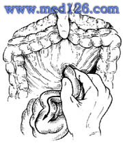 小肠:将横结肠及其系膜拉向上方,确诊十二指肠悬韧带(treitz韧带)后
